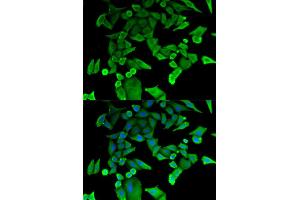 Immunofluorescence analysis of HeLa cells using TPT1 antibody. (TPT1 Antikörper)