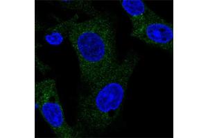 Immunofluorescent staining of human cell line Hep G2 with TANK polyclonal antibody  shows positivity in cytoplasm. (TANK Antikörper)