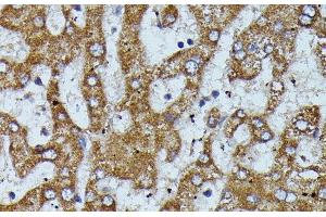 Immunohistochemistry of paraffin-embedded Human liver using APOC3 Polyclonal Antibody at dilution of 1:100 (40x lens). (APOC3 Antikörper)