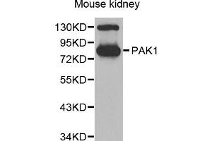 Western blot analysis of extracts of mouse kidney, using PAK1 antibody. (PAK1 Antikörper)