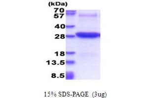 SDS-PAGE (SDS) image for Intercellular Adhesion Molecule 2 (ICAM2) (AA 22-223) protein (His tag) (ABIN7529265)