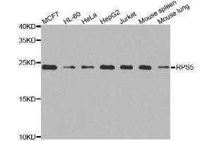 Western blot analysis of extracts of various cell lines, using RPS5 antibody.
