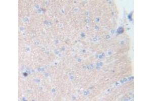 Used in DAB staining on fromalin fixed paraffin- embedded Kidney tissue (Integrin alpha 1 Antikörper  (AA 119-355))