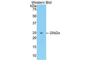Western Blotting (WB) image for anti-Fibronectin (AA 355-558) antibody (ABIN1078037) (Fibronectin Antikörper  (AA 355-558))