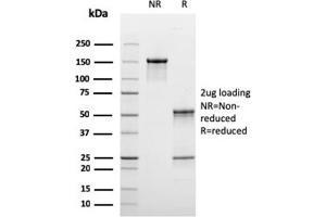 SDS-PAGE Analysis Purified C1QB Mouse Monoclonal Antibody (C1QB/2965). (C1QB Antikörper  (AA 41-188))