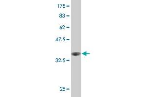 Western Blot detection against Immunogen (36. (LIM Domain Kinase 1 Antikörper  (AA 548-647))