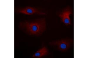 Immunofluorescent analysis of PAK1 staining in HEK293T cells. (PAK1 Antikörper  (Center))