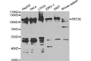 Western blot analysis of extracts of various cell lines, using EEF2K antibody. (EEF2K Antikörper)