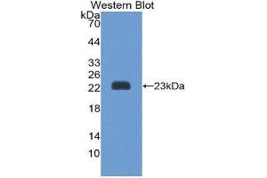Western Blotting (WB) image for anti-Peroxiredoxin 1 (PRDX1) (AA 1-199) antibody (ABIN1175811) (Peroxiredoxin 1 Antikörper  (AA 1-199))
