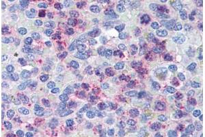 Human Spleen (formalin-fixed, paraffin-embedded) stained with CXCR4 antibody ABIN305765 at 5 ug/ml followed by biotinylated goat anti-rabbit IgG secondary antibody ABIN481713, alkaline phosphatase-streptavidin and chromogen. (CXCR4 Antikörper  (AA 182-196))