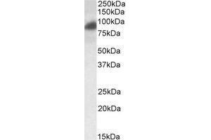 AP23769PU-N RAB11FIP1 antibody staining of HeLa lysate at 0. (RAB11FIP1 Antikörper  (Internal Region))