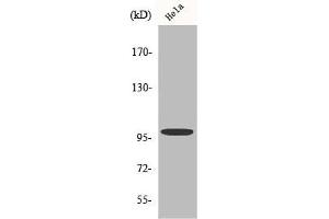 Western Blot analysis of HeLa cells using Catenin-α E/N Polyclonal Antibody (CTNNA2 Antikörper  (C-Term))