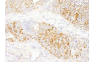 Immunohistochemistry (IHC) image for anti-Ribosomal Protein S6 (RPS6) (C-Term) antibody (ABIN7449016)