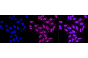 Immunocytochemical staining of HepG2 cells with Histone H2B (formyl K108) antibody (ABIN7798947), 1:1,000). (Rekombinanter Histone H2B Antikörper  (H2BK108fo))