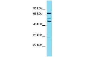 Western Blotting (WB) image for anti-Cortactin (CTTN) (N-Term) antibody (ABIN2774002) (Cortactin Antikörper  (N-Term))