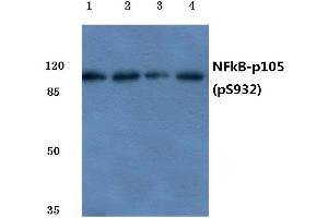 Western blot (WB) analysis of p-NFkB-p105 antibody at 1/500 dilution (NFKB1 Antikörper  (pSer932))