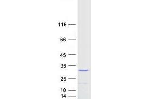 Validation with Western Blot (TNF alpha Protein (Myc-DYKDDDDK Tag))