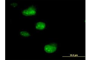 Immunofluorescence of purified MaxPab antibody to SSNA1 on HeLa cell. (SSNA1 Antikörper  (AA 1-119))