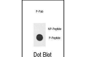 Dot blot analysis of Phospho-hE2F1- Pab (ABIN650836 and ABIN2839802) on nitrocellulose membrane. (E2F1 Antikörper  (His357))