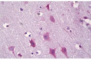 Anti-KCNIP3 / CSEN antibody IHC staining of human brain, cortex neurons. (DREAM Antikörper  (AA 29-78))