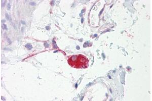 Anti-ADRA2A antibody IHC staining of human colon, submucosal plexus. (ADRA2A Antikörper  (AA 331-380))