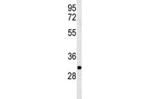 Western Blotting (WB) image for anti-Phosphoglycolate Phosphatase (PGP) (AA 33-62) antibody (ABIN3028923)