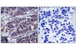Immunohistochemistry (IHC) image for anti-Docking Protein 1, 62kDa (Downstream of tyrosine Kinase 1) (DOK1) (pTyr362) antibody (ABIN7138991)