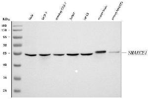Western blot analysis of BAF57/SMARCE1 using anti-BAF57/SMARCE1 antibody (ABIN7600326).