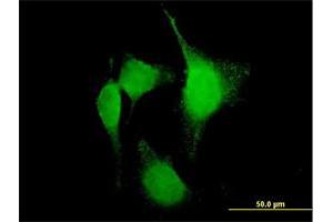 Immunofluorescence of purified MaxPab antibody to PTGS2 on HeLa cell. (PTGS2 Antikörper  (AA 1-604))