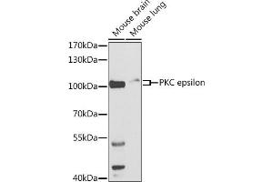 Western blot analysis of extracts of various cell lines, using PKC epsilon antibody (ABIN3022941, ABIN3022942, ABIN3022943 and ABIN6219308) at 1:500 dilution. (PKC epsilon Antikörper  (AA 488-737))