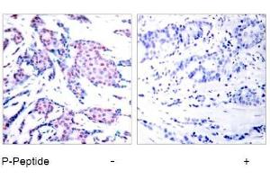 Image no. 1 for anti-Jun Proto-Oncogene (JUN) (pThr93) antibody (ABIN196648) (C-JUN Antikörper  (pThr93))