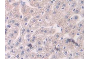 DAB staining on IHC-P; Samples: Mouse Liver Tissue (RALBP1 Antikörper  (AA 192-380))