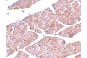 Immunohistochemistry of TRPC3 in mouse heart tissue with TRPC3 polyclonal antibody  at 2 ug/mL . (TRPC3 Antikörper  (C-Term))