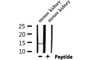 Western blot analysis of extracts from mouse kidney, using MSS4 Antibody. (RABIF Antikörper  (N-Term))