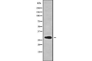 Western blot analysis NKX62 using COS7 whole cell lysates (NKX6-2 Antikörper)