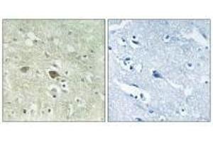 Immunohistochemistry analysis of paraffin-embedded human brain tissue using NDUFV3 antibody. (NDUFV3 Antikörper)