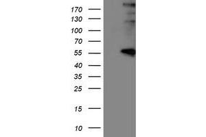 Western Blotting (WB) image for anti-Lysyl Oxidase (LOX) (AA 22-168) antibody (ABIN1491214) (LOX Antikörper  (AA 22-168))