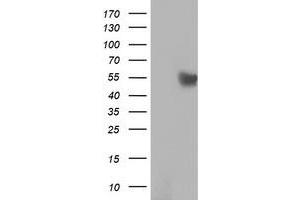 Western Blotting (WB) image for anti-RuvB-Like 2 (E. Coli) (RUVBL2) (AA 113-370) antibody (ABIN1490849) (RUVBL2 Antikörper  (AA 113-370))
