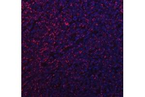 IF analysis of MFF using anti-MFF antibody (ABIN7599292).