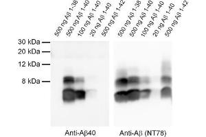 Detection of synthetic Abeta 1-38, 1-40 and 1-42 with anti-Abeta 40 (dilution 1 : 1000) and anti-Abeta (Cat. (Abeta 1-40 Antikörper  (AA 33-40))