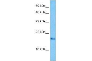 Host:  Mouse  Target Name:  GABARAP  Sample Tissue:  Mouse Skeletal Muscle  Antibody Dilution:  1ug/ml (GABARAP Antikörper  (N-Term))