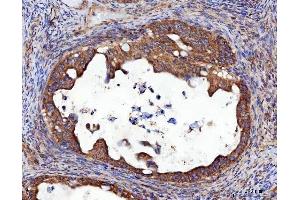 IHC analysis of RRS1 using anti-RRS1 antibody (ABIN7602918). (RRS1 Antikörper  (C-Term))