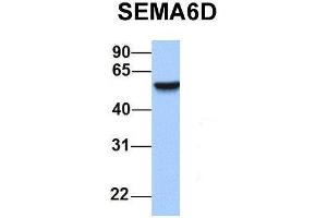 Host:  Rabbit  Target Name:  SEMA6D  Sample Type:  Human Adult Placenta  Antibody Dilution:  1. (SEMA6D Antikörper  (N-Term))