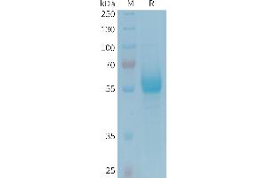 Killer Cell Lectin-Like Receptor Subfamily B, Member 1 (KLRB1) protein (Fc Tag)