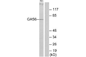 Immunohistochemistry analysis of paraffin-embedded human brain tissue using GAS6 antibody. (GAS6 Antikörper)