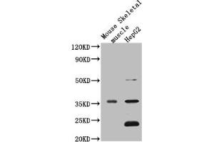 Western Blot Positive WB detected in: Mouse heart tissue, Mouse liver tissue, Mouse kidney tissue, Mouse brain tissue, Mouse skeletal muscle tissue, Mouse stomach tissue All lanes: MTND1 antibody at 3 μg/mL Secondary Goat polyclonal to rabbit IgG at 1/50000 dilution Predicted band size: 36 kDa Observed band size: 36 kDa (MT-ND1 Antikörper  (AA 23-67))