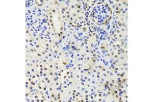 Immunohistochemistry of paraffin-embedded mouse kidney using EFTUD2 Antibody (ABIN5974236) at dilution of 1/100 (40x lens). (EFTUD2 Antikörper)