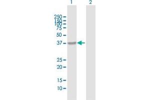 Western Blot analysis of PIH1D1 expression in transfected 293T cell line by PIH1D1 MaxPab polyclonal antibody.
