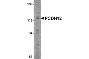 Western Blotting (WB) image for anti-Protocadherin 12 (PCDH12) (N-Term) antibody (ABIN1031505) (PCDH12 Antikörper  (N-Term))