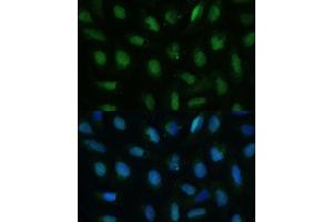 Immunofluorescence analysis of U-2 OS cells using DUT Polyclonal Antibody (ABIN7266736) at dilution of 1:100 (40x lens).